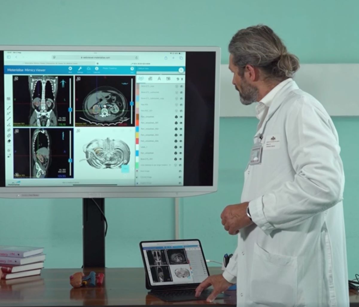 RAISE e la ricostruzione 3D degli organi: quando la tecnologia diventa pratica clinica