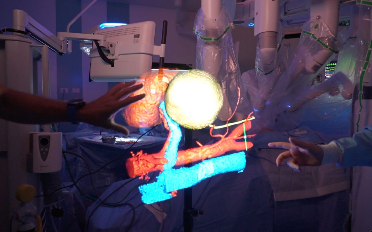 RAISE e la ricostruzione 3D degli organi: quando la tecnologia diventa pratica clinica